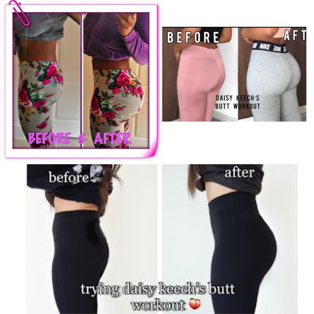 Sexy Hip Buttock Enlargement Cream - Image 6